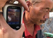 路人报警求助，受伤男子竟是“醉驾王”